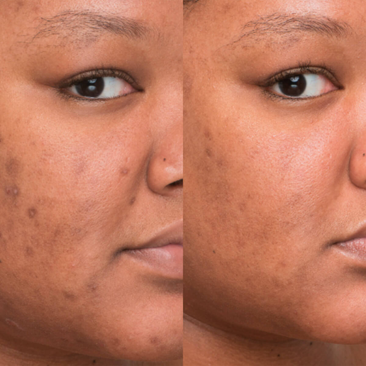 BYE BYE SERUM (SUEROS LUMINOSOS E HIDRATANTES PARA ROSTRO)